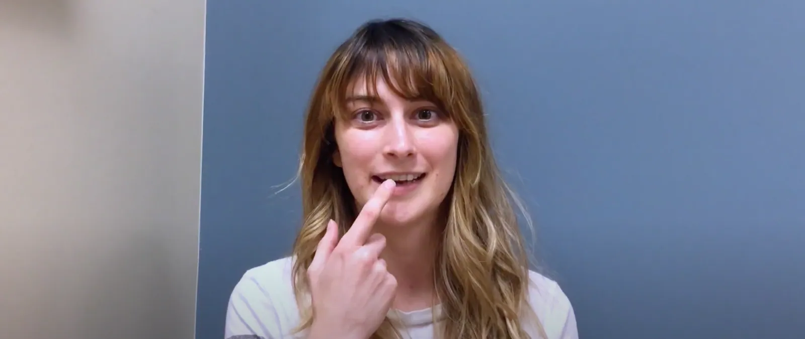 Hope sharing her smile reconstruction experience